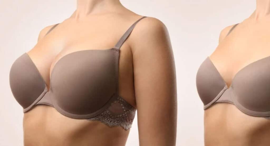 Woman before and after breast size correction on color background. Plastic surgery concept
