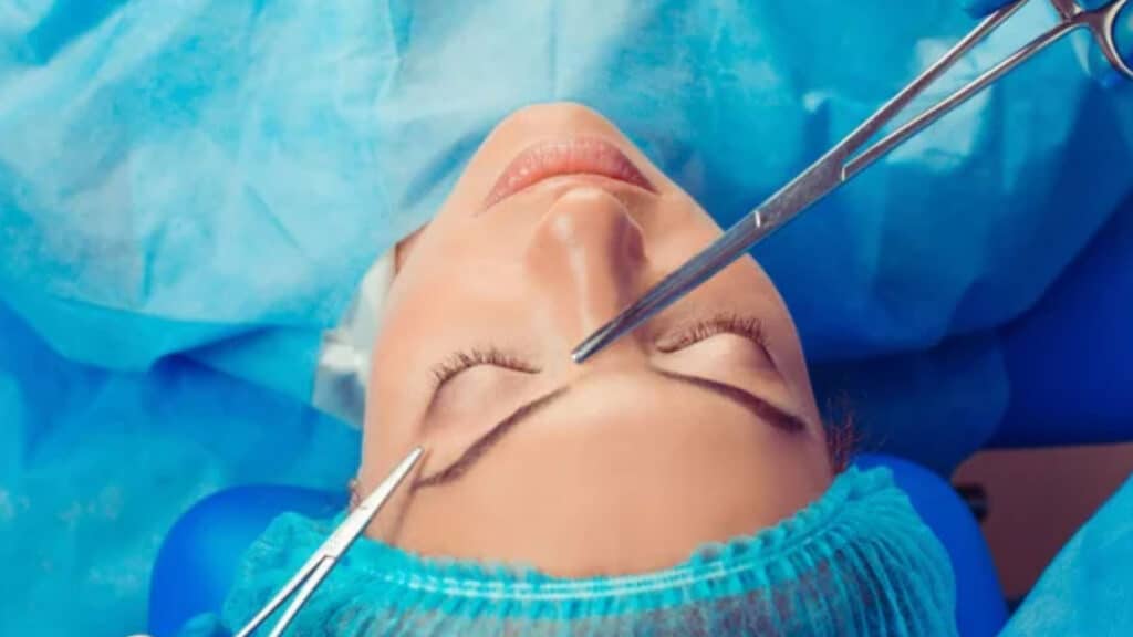 brow-lift-surgery