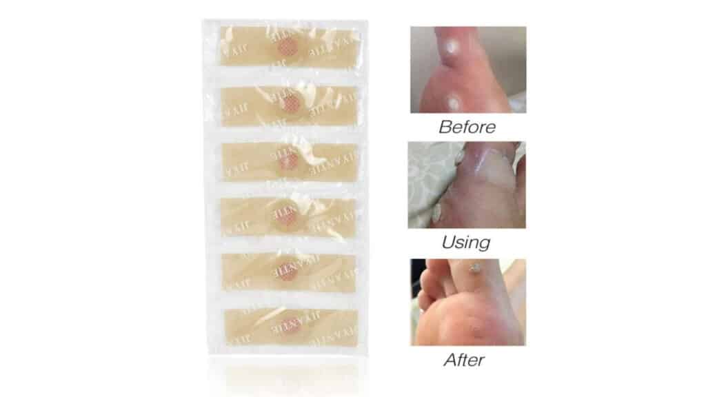 Painless-Medical-Plaster-Warts